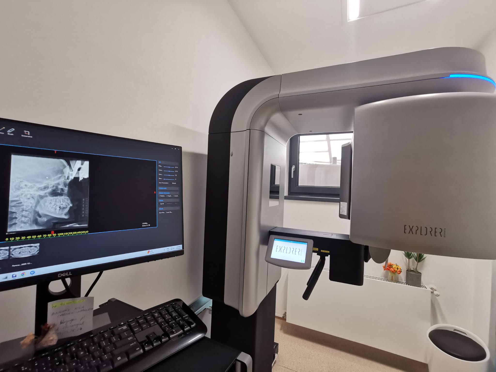 Read more about the article Vanzare produse: sistem complet de imagistică dentară PreXion3D Explorer